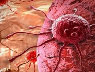 41fc10b1c75aeb015704529a50ed2daa 326x245 - Lékaři přišli na způsob, jak vyhladovět rakovinu