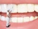 Zdravé zuby se bez vitamínů a minerálů neobejdou.