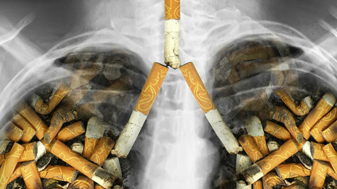 Rakovina plic zabíjí z 90 procent kuřáky.